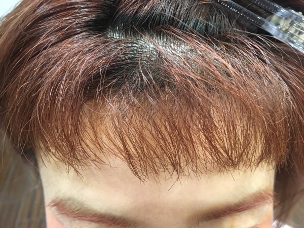 ストレートパーマや縮毛矯正でチリチリに失敗した前髪を修正するには Masaki Okajima